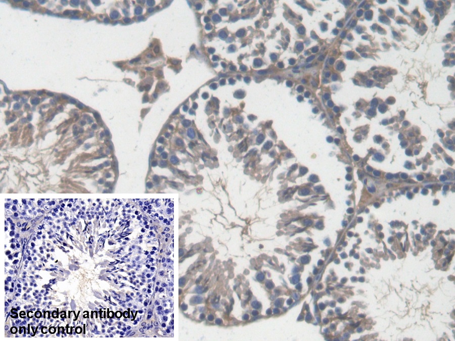 Polyclonal Antibody to Reticulocalbin 2 (RCN2)