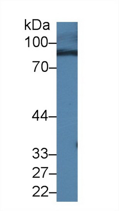 Polyclonal Antibody to RalA Binding Protein 1 (RALBP1)