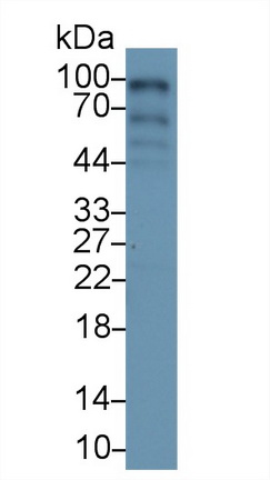 Polyclonal Antibody to RalA Binding Protein 1 (RALBP1)