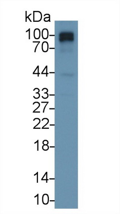 Polyclonal Antibody to RalA Binding Protein 1 (RALBP1)