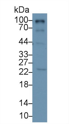 Polyclonal Antibody to RalA Binding Protein 1 (RALBP1)