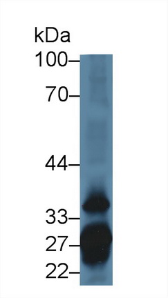 Polyclonal Antibody to Renal Tumor Antigen (RAGE)