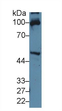 Polyclonal Antibody to Renal Tumor Antigen (RAGE)