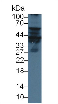 Polyclonal Antibody to Renal Tumor Antigen (RAGE)