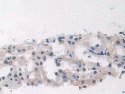 Polyclonal Antibody to Renal Tumor Antigen (RAGE)