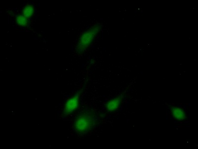 Polyclonal Antibody to Renal Tumor Antigen (RAGE)