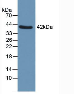 Polyclonal Antibody to Glutaminyl Peptide Cyclotransferase (QPCT)