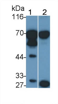 Polyclonal Antibody to Prolactin Receptor (PRLR)