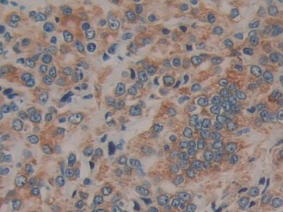 Polyclonal Antibody to Prolactin Receptor (PRLR)