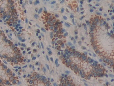 Polyclonal Antibody to Prolactin Receptor (PRLR)