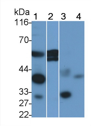 Polyclonal Antibody to Prolactin Receptor (PRLR)