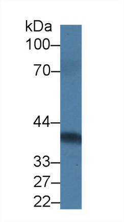 Polyclonal Antibody to Prolactin Receptor (PRLR)