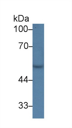 Polyclonal Antibody to Preferentially Expressed Antigen In Melanoma (PRAME)