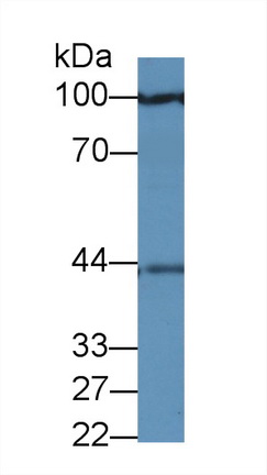 Polyclonal Antibody to Preferentially Expressed Antigen In Melanoma (PRAME)