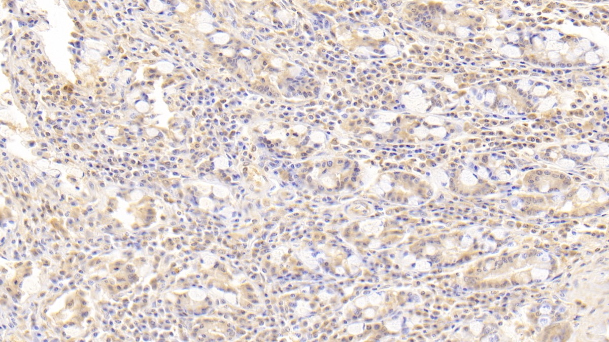 Polyclonal Antibody to Preferentially Expressed Antigen In Melanoma (PRAME)