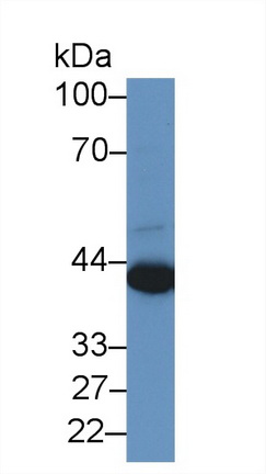 Polyclonal Antibody to Preferentially Expressed Antigen In Melanoma (PRAME)