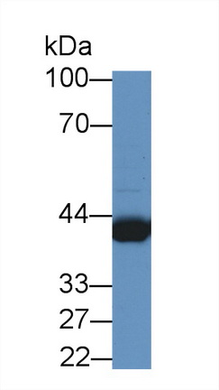 Polyclonal Antibody to Preferentially Expressed Antigen In Melanoma (PRAME)