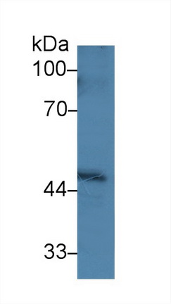 Polyclonal Antibody to Protein Phosphatase, Mg2+/Mn2+ Dependent 1A (PPM1A)