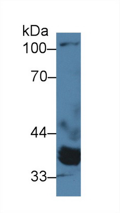 Polyclonal Antibody to Protein Phosphatase, Mg2+/Mn2+ Dependent 1A (PPM1A)