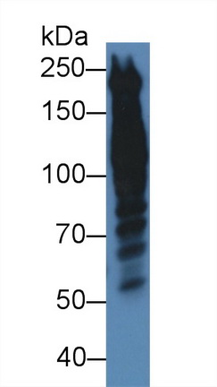 Polyclonal Antibody to Periplakin (PPL)