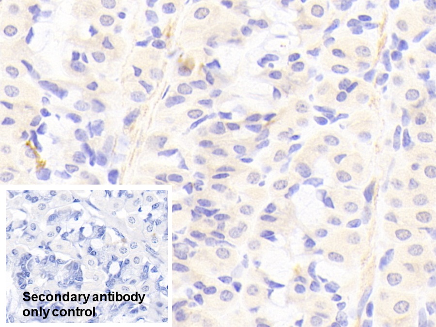 Polyclonal Antibody to Periplakin (PPL)