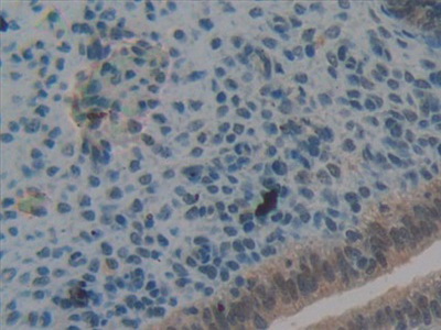 Polyclonal Antibody to Periplakin (PPL)