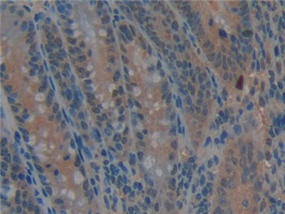 Polyclonal Antibody to Periplakin (PPL)