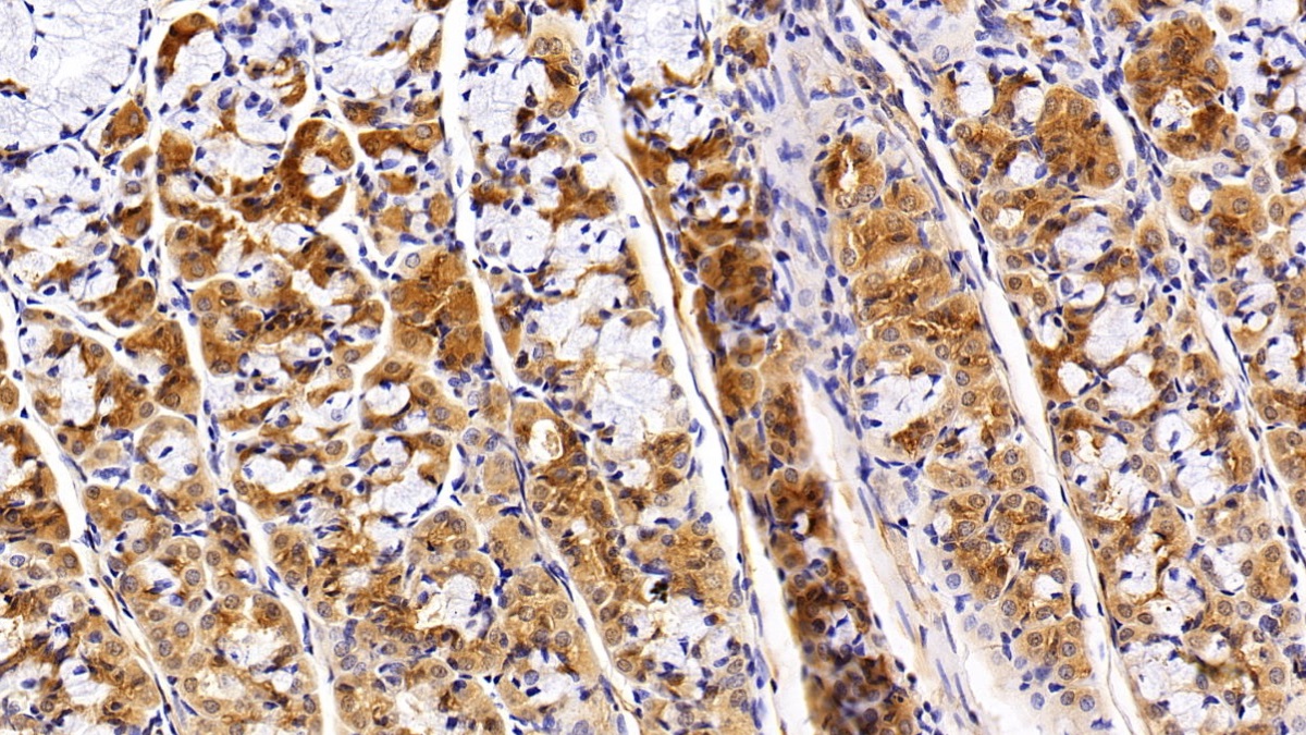 Polyclonal Antibody to Peroxisome Proliferator Activated Receptor Gamma Coactivator 1 Alpha (PPARgC1a)