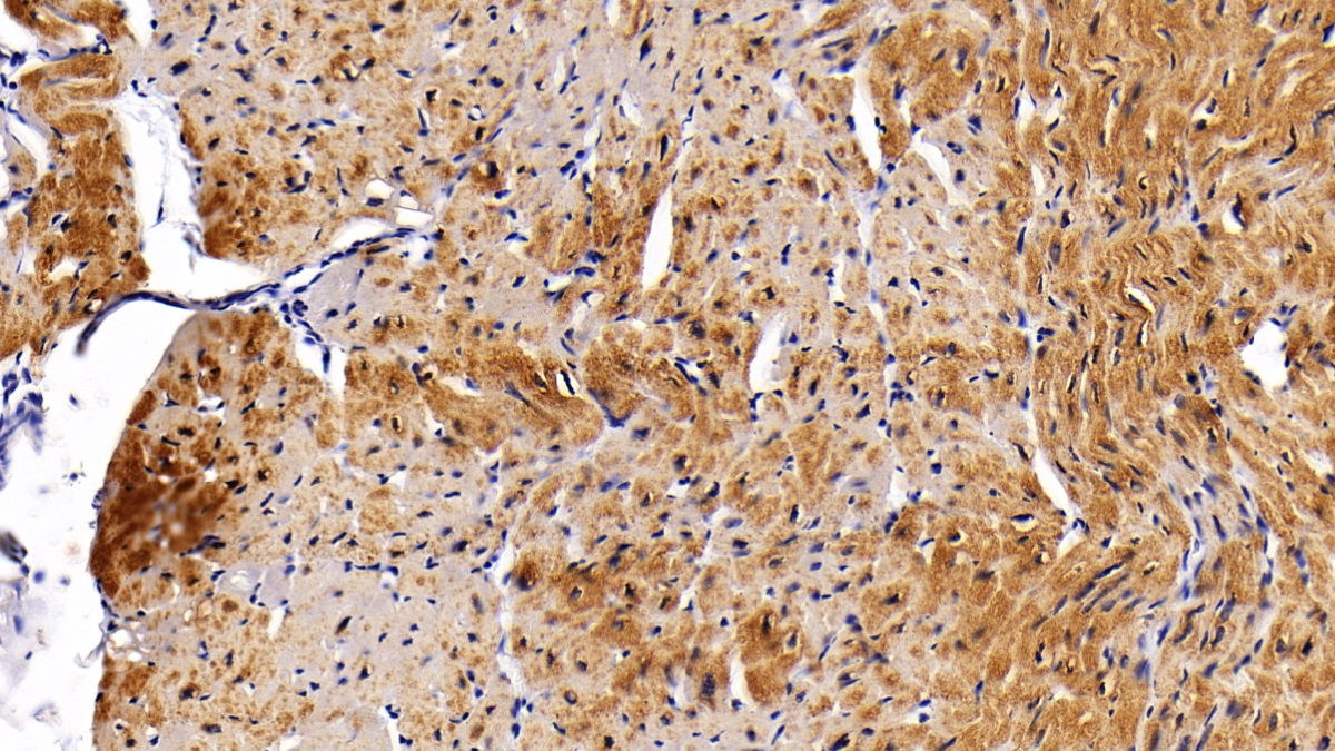 Polyclonal Antibody to Peroxisome Proliferator Activated Receptor Gamma Coactivator 1 Alpha (PPARgC1a)