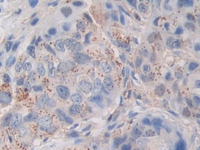 Polyclonal Antibody to Periostin (POSTN)