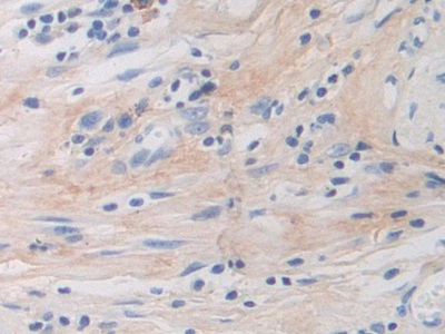 Polyclonal Antibody to Periostin (POSTN)