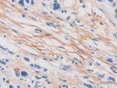 Polyclonal Antibody to Periostin (POSTN)