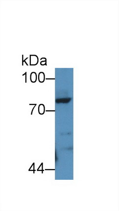 Polyclonal Antibody to Periostin (POSTN)