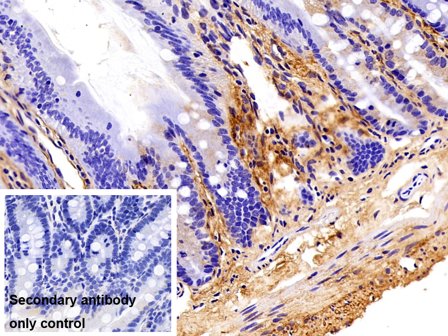 Polyclonal Antibody to Periostin (POSTN)