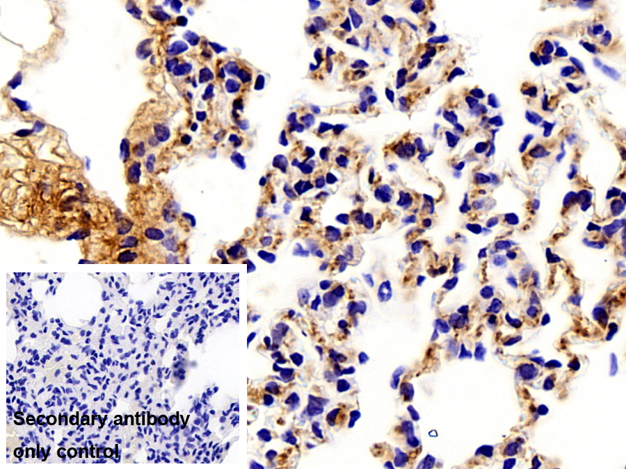 Polyclonal Antibody to Periostin (POSTN)