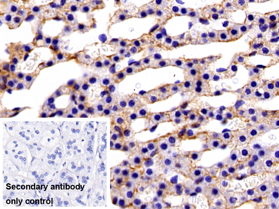 Polyclonal Antibody to Periostin (POSTN)