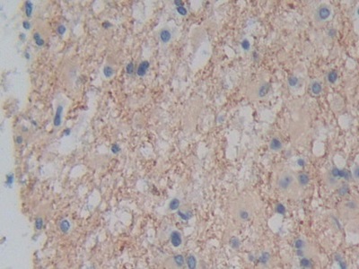 Polyclonal Antibody to Plexin A1 (PLXNA1)