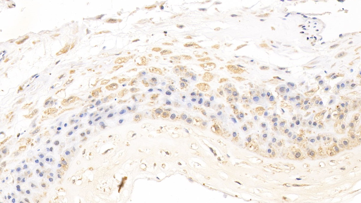 Polyclonal Antibody to Plexin B1 (PLXNB1)