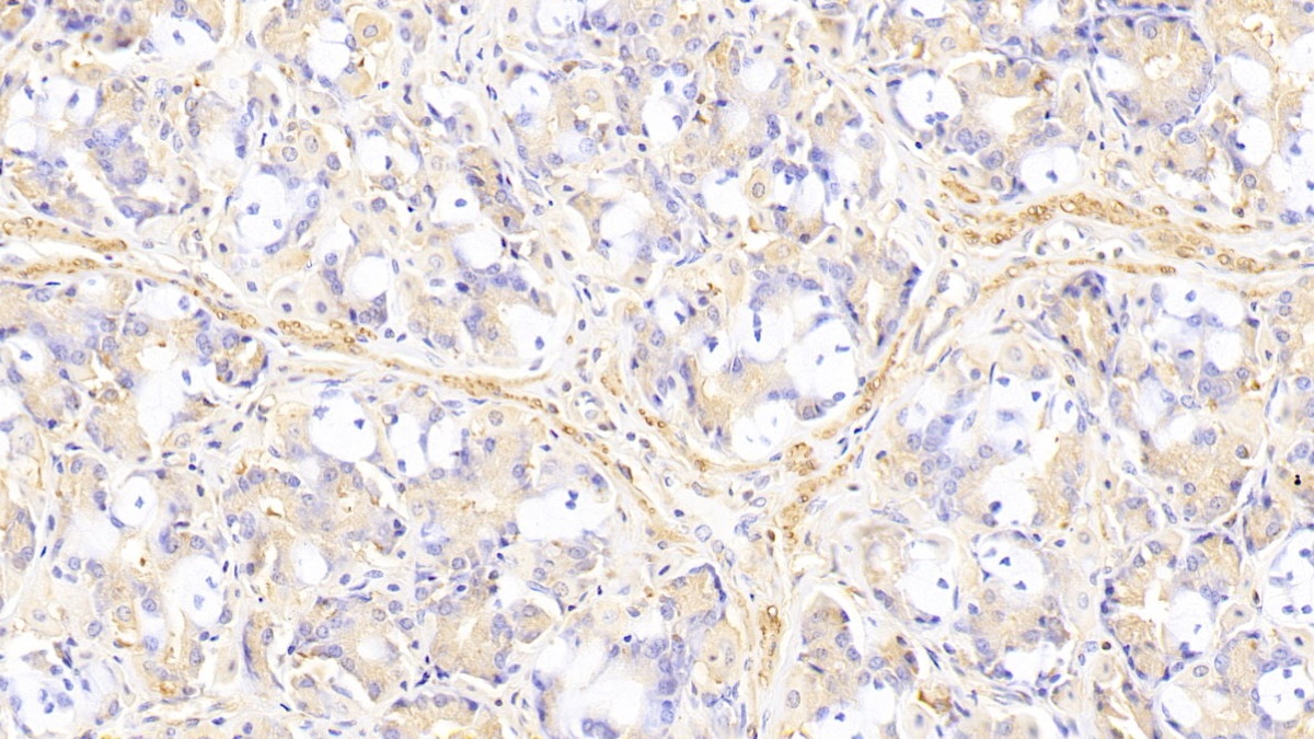 Polyclonal Antibody to Plastin 3 (PLS3)