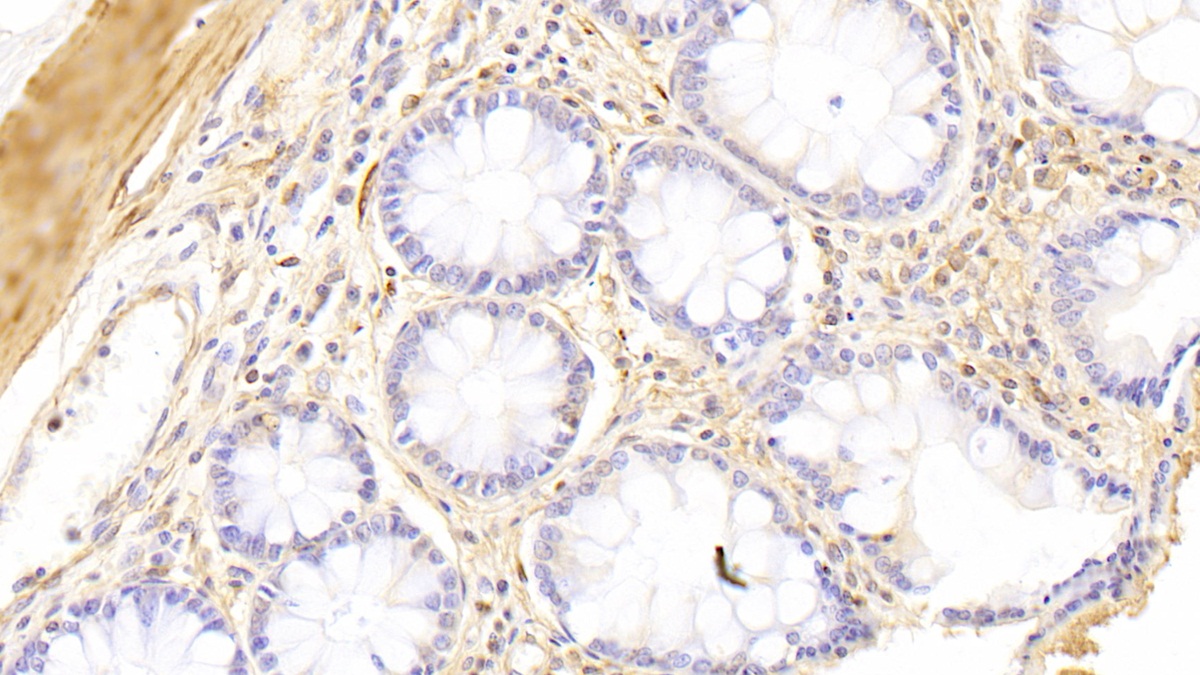 Polyclonal Antibody to Plastin 3 (PLS3)