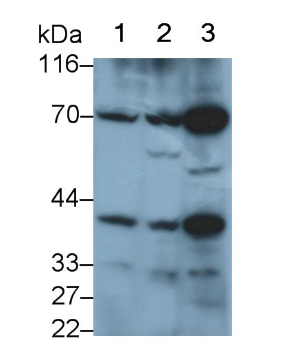 Polyclonal Antibody to Plastin 3 (PLS3)