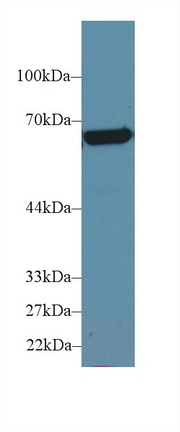 Polyclonal Antibody to Plastin 3 (PLS3)