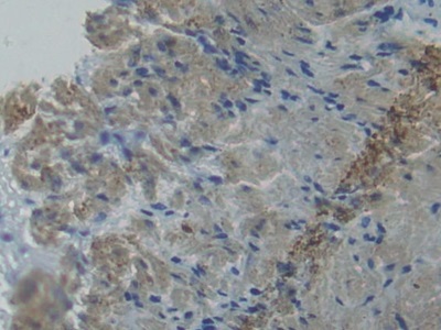 Polyclonal Antibody to Plastin 3 (PLS3)