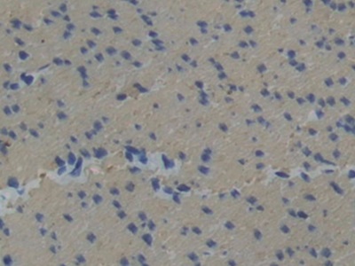 Polyclonal Antibody to Plastin 3 (PLS3)