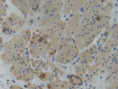 Polyclonal Antibody to Plastin 3 (PLS3)