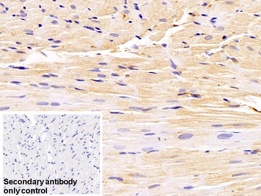 Polyclonal Antibody to Plastin 3 (PLS3)