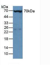 Polyclonal Antibody to Plastin 3 (PLS3)