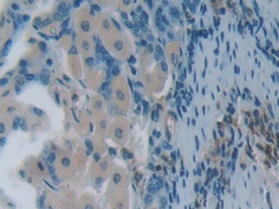 Polyclonal Antibody to Plastin 3 (PLS3)