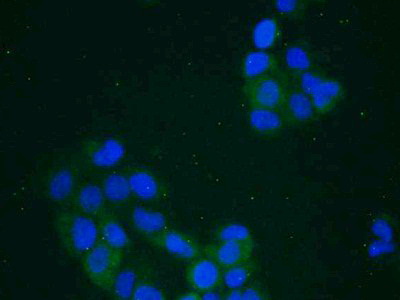 Polyclonal Antibody to Plastin 3 (PLS3)