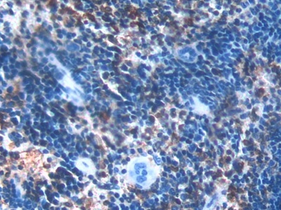 Polyclonal Antibody to Plastin 3 (PLS3)